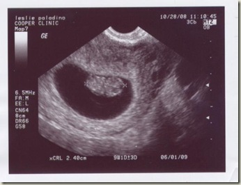 Baby Paladino 1st Ultrasound