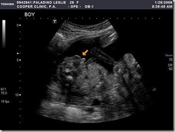 I20090126083752578